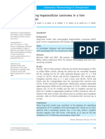 ATP - Benefit of Downsizing Hepatocellular Carcinoma in A Liver Transplant Population