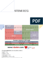 Stemi Ecg