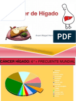 Cáncer de Hígado