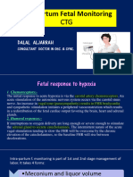 Intrapartum Fetal Monitoring: Dalal Aljarrah