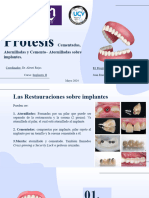 Juan - Prótesis Cementadas, Atornilladas y Cemento Atornilladas Sobre Implantes