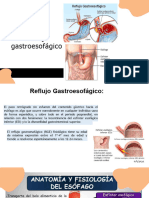 Reflujo Gastro Esofagico