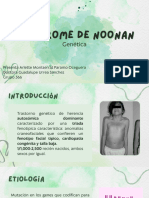 Sindrome Noonan