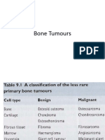 Bone Tumours, Osteosarcoma