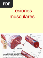 17 Lesiones Musculares