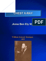 Chest X-Ray Anna