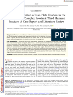 Orthopaedic Surgery - 2022 - Bi - Clinical Application of Nail Plate Fixation in The Treatment of Compl