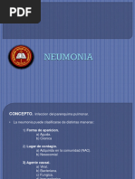 Neumonia