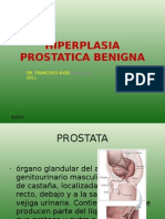 Hiperplasia Prostatica Benigna