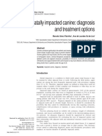 Palatally Impacted Canines - Diagnosis and Treatment Options