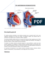 Conducto Arterioso Persistente