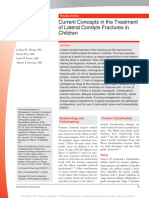 Current Concepts in The Treatment of Lateral Condyle Fractures in Children