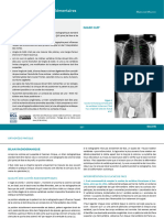 Scoliose Examens Complémentaires Rachis