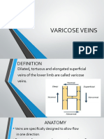 Varicose Veins