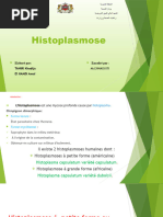 Histoplasmose