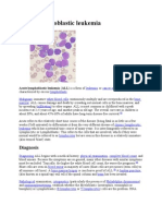 Acute Lymphoblastic Leukemia