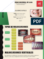 MALOCLUSIONES 