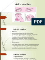 Artritis Reactiva, Psoriasica y Enteropatica