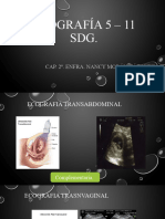 Ecografía 5 - 11 SDG