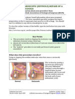 Laparoscopic Keyhole Repair of A Varicocele