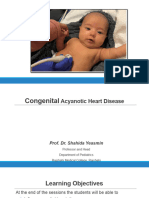 Congenital Acyanotic Heart Disease