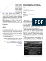 Apport de L'échographie Pour La Réalisation D'un Bloc Paravertébral Thoracique Bilatéral Chez Un Patient Obèse - 2011 - 30 - 2