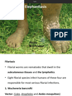 Filariasis