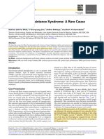 Type B Insulin Resistance Syndrome - A Rare Cause of Hypoglycemia