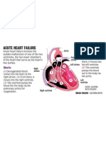 Acute Heart Failure