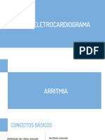 Arritmias ECG Cardio