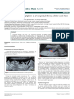 Incarcerated Wandering Spleen in A Congenital Hernia of The Cord First Case Report 2572 0775 1000142