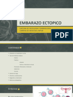 Emb Ectopico