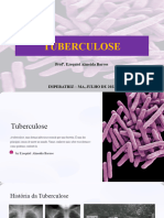 Tuberculose