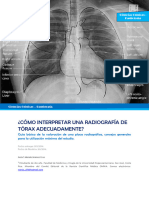 ¿Cómo Interpretar Una Radiografía de Tórax Adecuadamente?