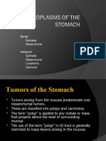 Git.l3-Neoplasms of The Stomach