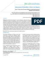 Plasmacytoma