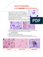 NEUROPATOLOGÍA