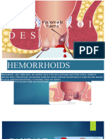 HEMORRHOIDS