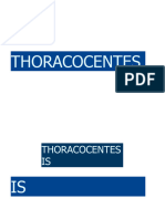 THORACOCENTESIS