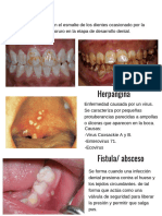 Preventiva (1) - Removed