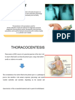 THORACOCENTESIS