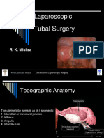 Laparoscopic Salpingo Oophorectomy