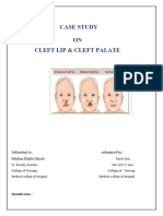 Case Study On Cleft Lip, Cleft Palate