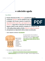 Colelitase e Colecistite Aguda