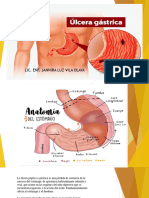 .20ulcera Gastrica