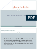 ArtroplastiadeJoelhoEAD 20230228182946