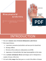 Rheumatoid Arthritis