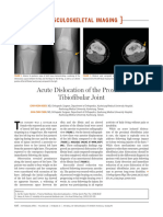 Acute Dislocation of The Proximal Tibiofibular Joint, 2009.