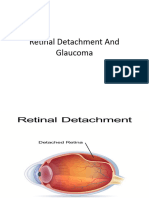 Glaucoma and Retinal Detachment