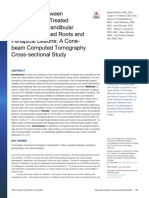 Association Between Endodontically Treated Maxilla